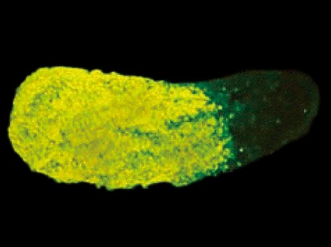 Immunofluorescence-stained pseudoplasmodium (Photo courtesy of Ikuo Takeuchi)