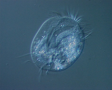 Euplotes aediculatus, a unicellular organism that looks just like a water flea.