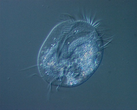 ユープロテス Euplotes aediculatus。まるでミジンコ（節足動物）のような単細胞生物。